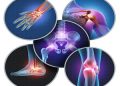 Vitamin D and Bone Health